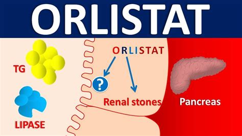 Orlistat Oral: Uses, Side Effects, Interactions, Pictures.